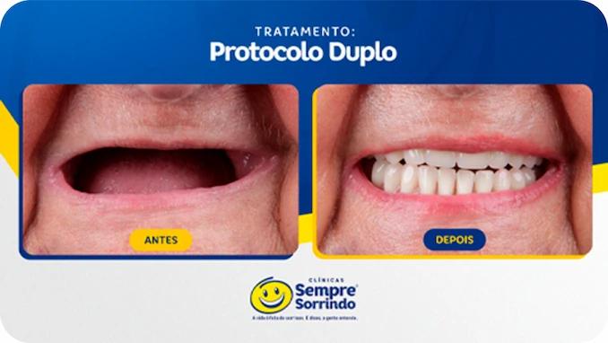 foto de antes e depois do sorriso de um dos pacientes.