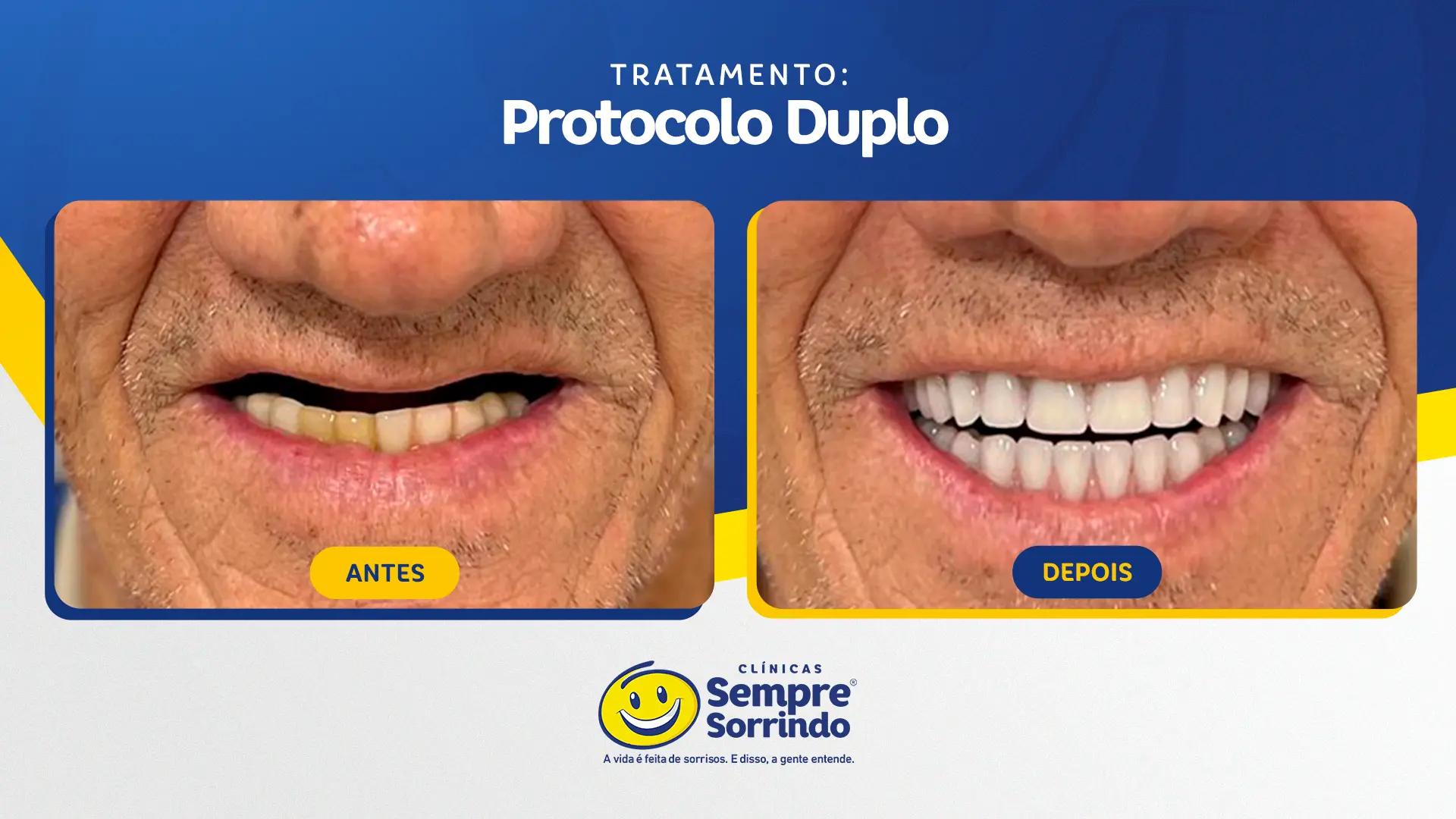 foto de antes e depois do sorriso de um dos pacientes.